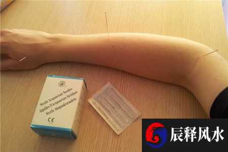 梦见针灸是什么意思(梦见 针灸)